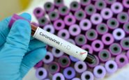 coronavirus tests